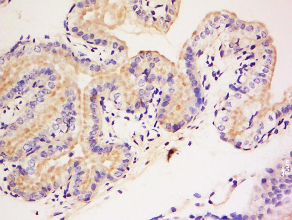 Formalin-fixed and paraffin embedded mouse placenta labeled with Anti-DAGLB Polyclonal Antibody, Unconjugated (bs-14190R) at 1:200 followed by conjugation to the secondary antibody and DAB staining.