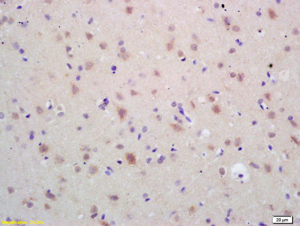 Formalin-fixed and paraffin embedded rat brain labeled with  Rabbit Anti HSP60 Polyclonal Antibody, Unconjugated (bs-0191R) at 1:200 followed by conjugation to the secondary antibody and DAB staining