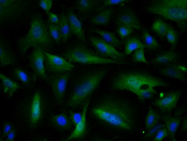 Image provided by One World Lab validation program. A549 cells probed with Rabbit Anti-ATM Polyclonal Antibody (bs-1370R) at 1:50 for 60 minutes at room temperature followed by Goat Anti-Rabbit IgG (H+L) Alexa Fluor 488 Conjugated secondary antibody. Image provided by One World Lab validation program. A549 cells probed with Rabbit Anti-ATM Polyclonal Antibody (bs-1370R) at 1:50 for 60 minutes at room temperature followed by Goat Anti-Rabbit IgG (H+L) Alexa Fluor 488 Conjugated secondary antibody.