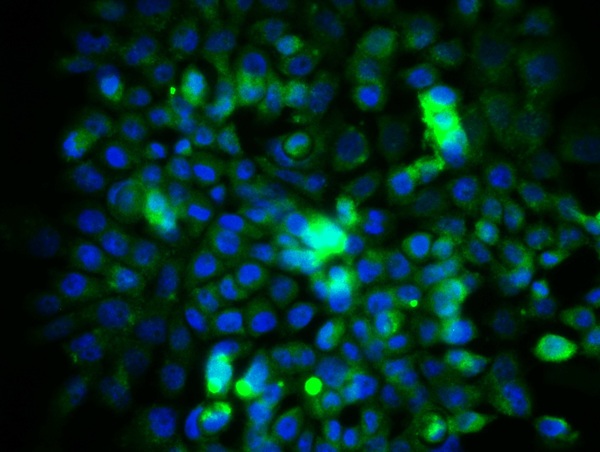 Image provided by One World Lab validation program. A431 cells probed with Rabbit Anti-eIF4E Polyclonal Antibody (bs-4979R) at 1:50 for 60 minutes at room temperature followed by Goat Anti-Rabbit IgG (H+L) Alexa Fluor 488 Conjugated secondary antibody.