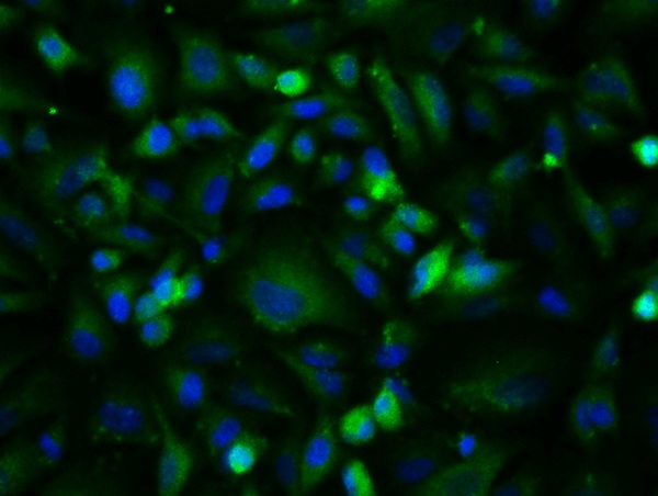Image provided by One World Lab validation program. A549 cells probed with Rabbit Anti-bFGF Polyclonal Antibody (bs-0217R) at 1:50 for 60 minutes at room temperature followed by Goat Anti-Rabbit IgG (H+L) Alexa Fluor 488 Conjugated secondary antibody.