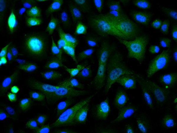 Image provided by One World Lab validation program. A549 cells probed with Rabbit Anti-c-Jun Polyclonal Antibody (bs-0670R) at 1:50 for 60 minutes at room temperature followed by Goat Anti-Rabbit IgG (H+L) Alexa Fluor 488 Conjugated secondary antibody.
