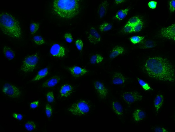Image provided by One World Lab validation program. A549 cells probed with Rabbit Anti-GFAP Polyclonal Antibody (bs-0199R) at 1:50 for 60 minutes at room temperature followed by Goat Anti-Rabbit IgG (H+L) Alexa Fluor 488 Conjugated secondary antibody.