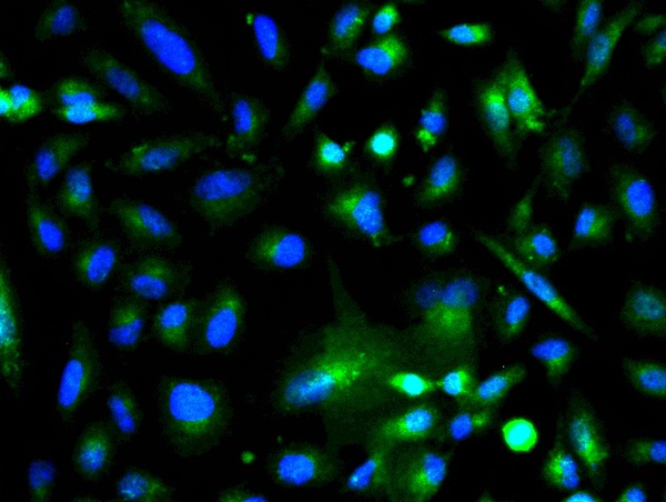 Image provided by One World Lab validation program. A549 cells probed with Rabbit Anti-GSK-3 Beta Polyclonal Antibody (bs-0028R) at 1:50 for 60 minutes at room temperature followed by Goat Anti-Rabbit IgG (H+L) Alexa Fluor 488 Conjugated secondary antibody.