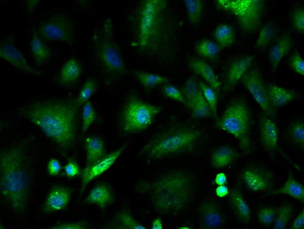 Image provided by One World Lab validation program. A549 cells probed with Rabbit Anti-ILK-1 Polyclonal Antibody (bs-0317R) at 1:50 for 60 minutes at room temperature followed by Goat Anti-Rabbit IgG (H+L) Alexa Fluor 488 Conjugated secondary antibody.