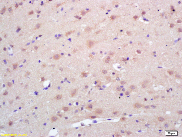 Formalin-fixed and paraffin embedded rat brain labeled with  Rabbit Anti Trk A\/B\/C Polyclonal Antibody, Unconjugated (bs-0192R) at 1:200 followed by conjugation to the secondary antibody and DAB staining