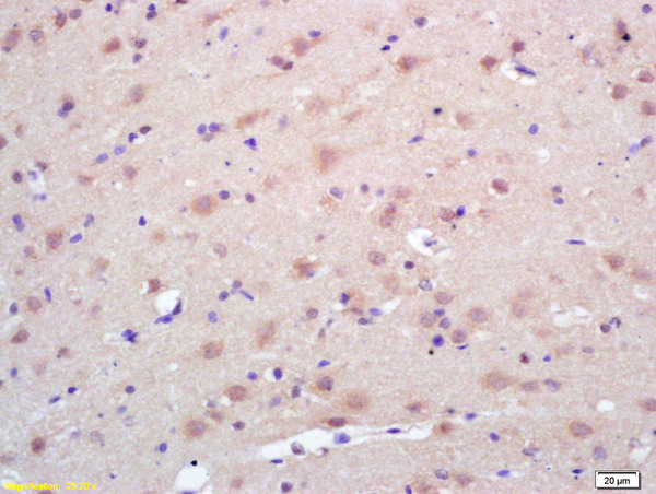 Formalin-fixed and paraffin embedded rat brain labeled with Rabbit Anti Trk A/B/C Polyclonal Antibody, Unconjugated (bs-0192R) at 1:200 followed by conjugation to the secondary antibody and DAB staining