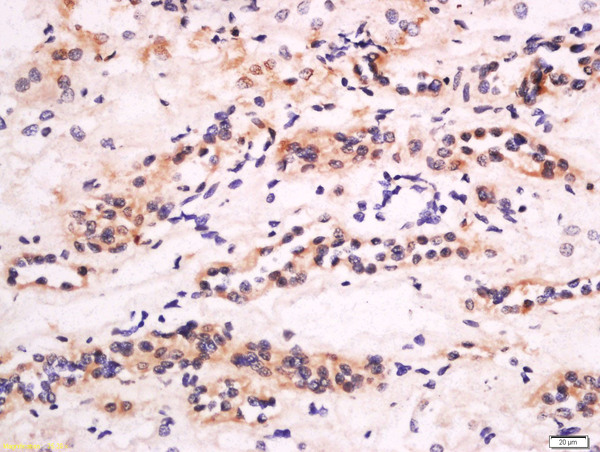 Formalin-fixed and paraffin embedded human kidney labeled with Anti-CXCL14 Polyclonal Antibody, Unconjugated (bs-1503R) at 1:200 followed by conjugation to the secondary antibody and DAB staining.