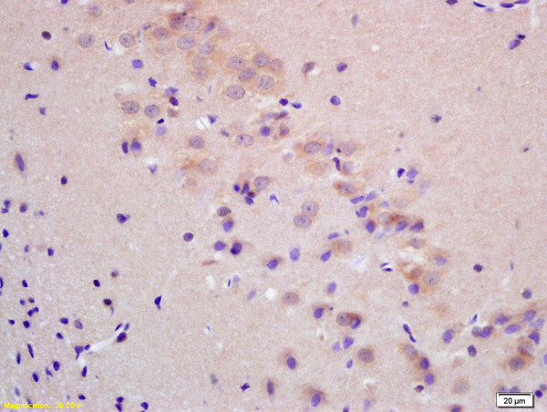 Formalin-fixed and paraffin embedded rat brain labeled with  Rabbit Anti ChRM2 Polyclonal Antibody, Unconjugated (bs-0441R) at 1:200 followed by conjugation to the secondary antibody and DAB staining