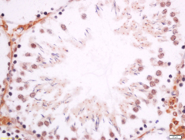 Formalin-fixed and paraffin embedded mouse testis labeled with Anti-DMO/Dmrt1a Polyclonal Antibody, Unconjugated (bs-11276R) at 1:200 followed by conjugation to the secondary antibody and DAB staining. Formalin-fixed and paraffin embedded mouse testis labeled with Anti-DMO/Dmrt1a Polyclonal Antibody, Unconjugated (bs-11276R) at 1:200 followed by conjugation to the secondary antibody and DAB staining.