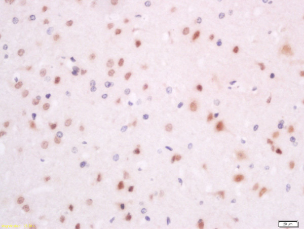 Formalin-fixed and paraffin embedded rat brain labeled with Anti-SFRS7/9G8 Polyclonal Antibody, Unconjugated (bs-11755R) at 1:200 followed by conjugation to the secondary antibody and DAB staining