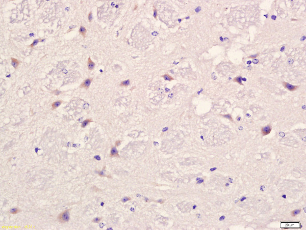 Formalin-fixed and paraffin embedded mouse brain labeled with Anti-PLAUR Polyclonal Antibody, Unconjugated (bs-1927R) at 1:200 followed by conjugation to the secondary antibody and DAB staining.\n