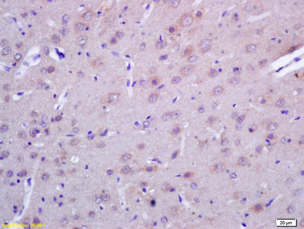 Formalin-fixed and paraffin embedded rat brain labeled with  Rabbit Anti ACTH (1-39) Polyclonal Antibody, Unconjugated (bs-0443R) at 1:200 followed by conjugation to the secondary antibody and DAB staining