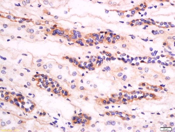 Formalin-fixed and paraffin embedded human kidney labeled with Anti-GM2A Polyclonal Antibody, Unconjugated (bs-13452R) at 1:200 followed by conjugation to the secondary antibody and DAB staining