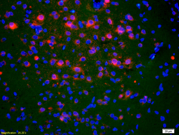 Formalin-fixed and paraffin-embedded rat brain labeled with Anti-ACTH (1-39) Polyclonal Antibody, Unconjugated(bs-0443R) 1:200, overnight at 4\u00b0C, The secondary antibody was Goat Anti-Rabbit IgG, Cy3 conjugated(bs-0295G-Cy3)used at 1:200 dilution for 40 minutes at 37\u00b0C.