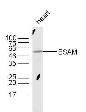 Mouse heart lysates probed with Rabbit Anti-ESAM Polyclonal Antibody, Unconjugated (bs-5838R) at 1:300 overnight at 4˚C. Followed by a conjugated secondary antibody at 1:5000 for 90 min at 37˚C.