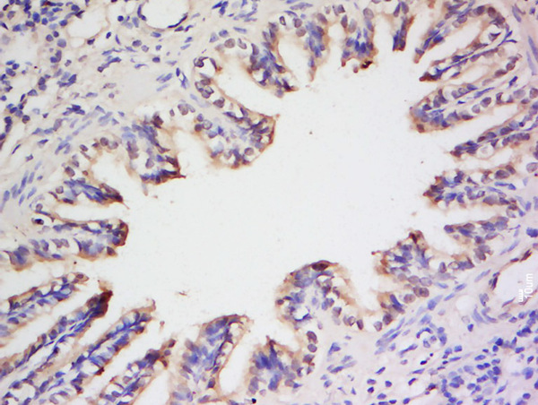 Formalin-fixed and paraffin embedded rat lung labeled with  Anti- Preproendothelin 1 Polyclonal Antibody, Unconjugated (bs-0188R) at 1:200 followed by conjugation to the secondary antibody and DAB staining