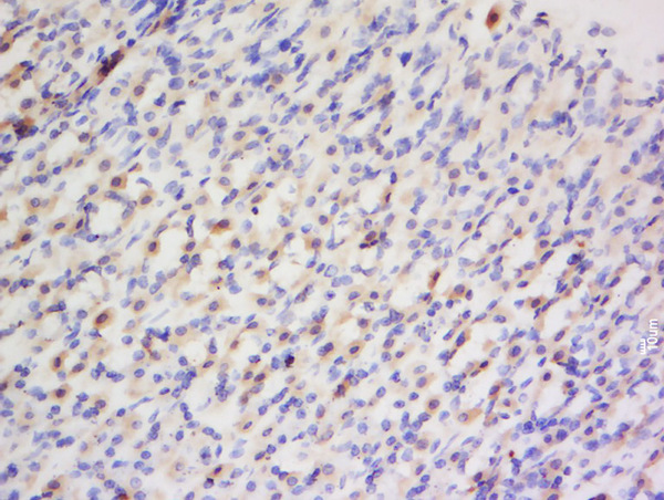 Formalin-fixed and paraffin embedded rat stomach labeled with Anti- Preproendothelin 1 Polyclonal Antibody, Unconjugated (bs-0188R) at 1:200 followed by conjugation to the secondary antibody and DAB staining.