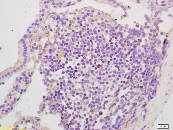 Formalin-fixed and paraffin embedded mouse intestine labeled with  Rabbit Anti EphA2\/Eph receptor A2 Polyclonal Antibody, Unconjugated (bs-0485R) at 1:200 followed by conjugation to the secondary antibody and DAB staining