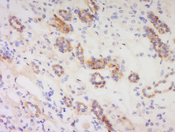 Formalin-fixed and paraffin embedded human kidney labeled with Anti-PACAP-38 Polyclonal Antibody, Unconjugated (bs-0200R) at 1:200 followed by conjugation to the secondary antibody and DAB staining.