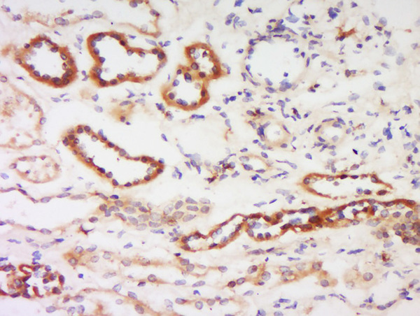 Formalin-fixed and paraffin embedded human kidney labeled with Anti-Protein kinase C beta, Isoform II Polyclonal Antibody, Unconjugated (bs-0267R) at 1:200 followed by conjugation to the secondary antibody and DAB staining. Formalin-fixed and paraffin embedded human kidney labeled with Anti-Protein kinase C beta, Isoform II Polyclonal Antibody, Unconjugated (bs-0267R) at 1:200 followed by conjugation to the secondary antibody and DAB staining.