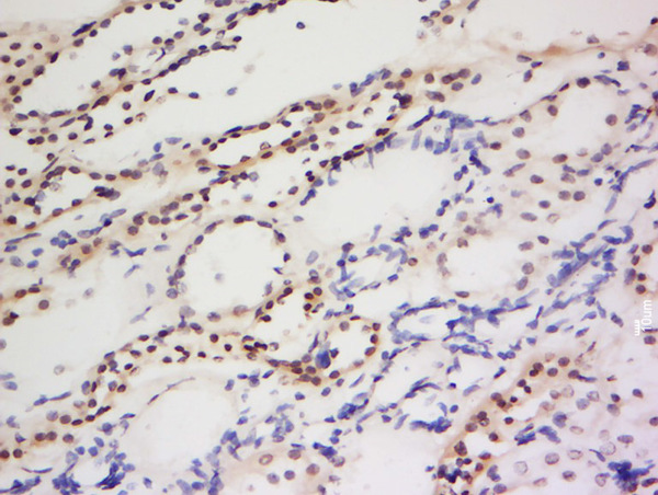 Formalin-fixed and paraffin embedded human kidney labeled with Anti-PIWIL1 Polyclonal Antibody, Unconjugated (bs-0665R) at 1:200 followed by conjugation to the secondary antibody and DAB staining.