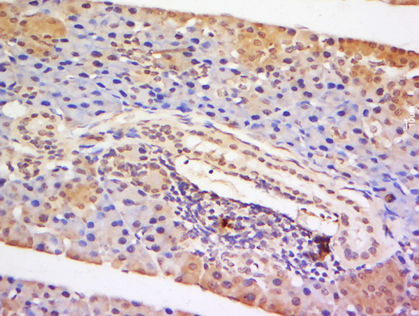 Formalin-fixed and paraffin embedded mouse lymph node tissue labeled with Anti-STAT5 Polyclonal Antibody, Unconjugated (bs-1142R) at 1:200 followed by conjugation to the secondary antibody and DAB staining