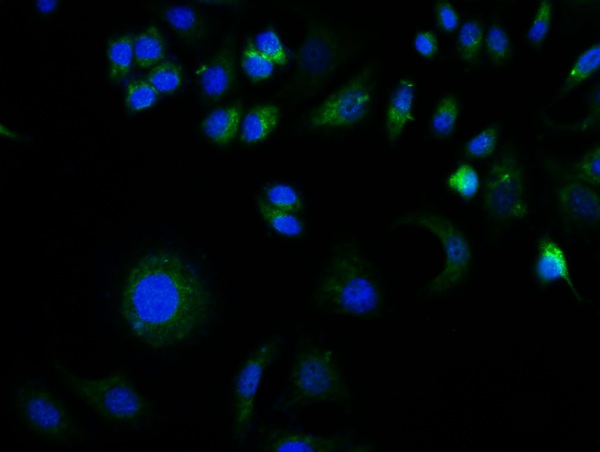 Image provided by One World Lab validation program. MCF-7 cells probed with Rabbit Anti-GFAP Polyclonal Antibody (bs-0199R) at 1:200 for 60 minutes at room temperature followed by Goat Anti-Rabbit IgG (H+L) Alexa Fluor 488 Conjugated secondary antibody.\\n