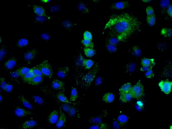 Image provided by One World Lab validation program. MCF-7 cells probed with Rabbit Anti-ILK-1 Polyclonal Antibody (bs-0317R) at 1:50 for 60 minutes at room temperature followed by Goat Anti-Rabbit IgG (H+L) Alexa Fluor 488 Conjugated secondary antibody.\n