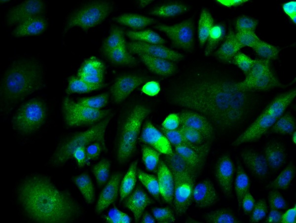 Image provided by One World Lab validation program. MCF-7 cells probed with Rabbit Anti-XIAP Polyclonal Antibody (bs-1281R) at 1:50 for 60 minutes at room temperature followed by Goat Anti-Rabbit IgG (H+L) Alexa Fluor 488 Conjugated secondary antibody.\\n