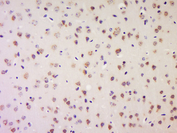 Formalin-fixed and paraffin embedded mouse brain labeled with Anti-LRP1/CD91 Polyclonal Antibody, Unconjugated (bs-2677R) at 1:200 followed by conjugation to the secondary antibody and DAB staining.