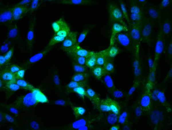 Image provided by One World Lab validation program. U138 cells probed with Rabbit Anti-c-Jun Polyclonal Antibody (bs-0670R) at 1:50 for 60 minutes at room temperature followed by Goat Anti-Rabbit IgG (H+L) Alexa Fluor 488 Conjugated secondary antibody.\\n