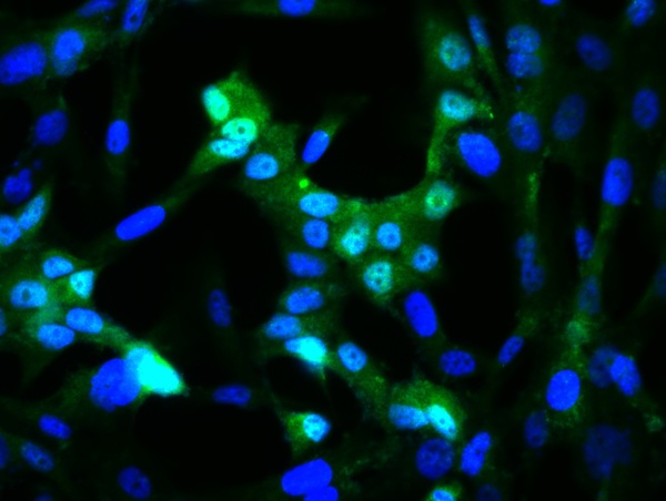 Image provided by One World Lab validation program. U138 cells probed with Rabbit Anti-c-Jun Polyclonal Antibody (bs-0670R) at 1:50 for 60 minutes at room temperature followed by Goat Anti-Rabbit IgG (H+L) Alexa Fluor 488 Conjugated secondary antibody.\n