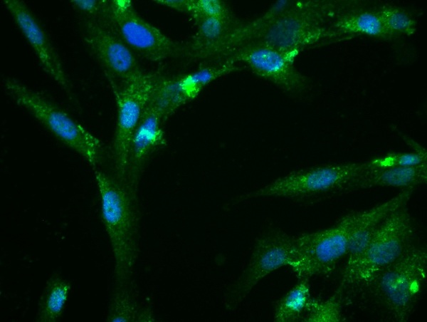 Image provided by One World Lab validation program. U138 cells probed with Rabbit Anti-Fibronectin Polyclonal Antibody (bs-0666R) at 1:50 for 60 minutes at room temperature followed by Goat Anti-Rabbit IgG (H+L) Alexa Fluor 488 Conjugated secondary antibody.