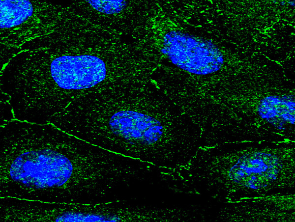 This image was generously provided by Piotr Mamczur at University of Wroclaw as part of the Bioss Discovery Program. Mouse squamous cell carcinoma (KLN-205 cell line) were probed with Rabbit Anti-RPS6KB1 Polyclonal Antibody (bs-1426R) at 1:100 followed by at FITC conjugated secondary antibody and DAPI staining