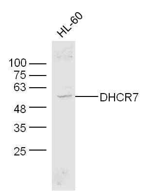 Human HL-60 cell lysates probed with Anti-DHCR7 Polyclonal Antibody, Unconjugated (bs-5057R) at 1:300 overnight at 4˚C. Followed by a conjugated secondary antibody (bs-0295G-HRP) at 1:10000 for 90 min at 37˚C.