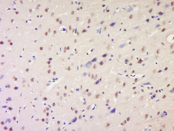 Formalin-fixed and paraffin embedded rat brain labeled with Anti-NSD1 Polyclonal Antibody, Unconjugated (bs-8170R) at 1:200 followed by conjugation to the secondary antibody and DAB staining.