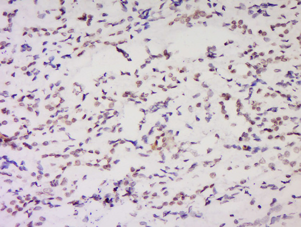 Formalin-fixed and paraffin embedded rat brain labeled with Anti-NSD1 Polyclonal Antibody, Unconjugated (bs-8170R) at 1:200 followed by conjugation to the secondary antibody and DAB staining.