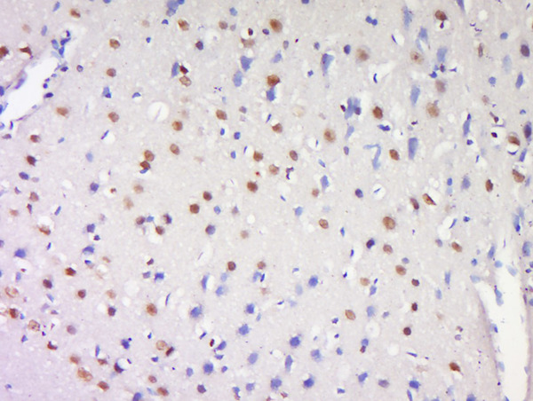 Formalin-fixed and paraffin embedded rat brain labeled with Anti-ProSAPiP1 Polyclonal Antibody, Unconjugated (bs-11198R) at 1:200 followed by conjugation to the secondary antibody and DAB staining