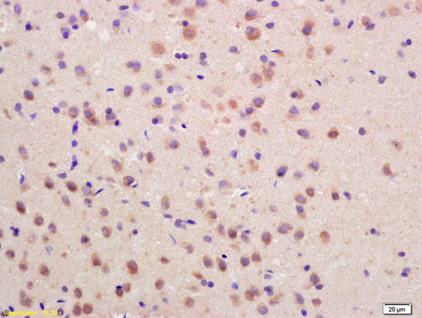 Formalin-fixed and paraffin embedded rat brain labeled with Rabbit Anti SOCS3 Polyclonal Antibody, Unconjugated (bs-0580R) at 1:200 followed by conjugation to the secondary antibody and DAB staining