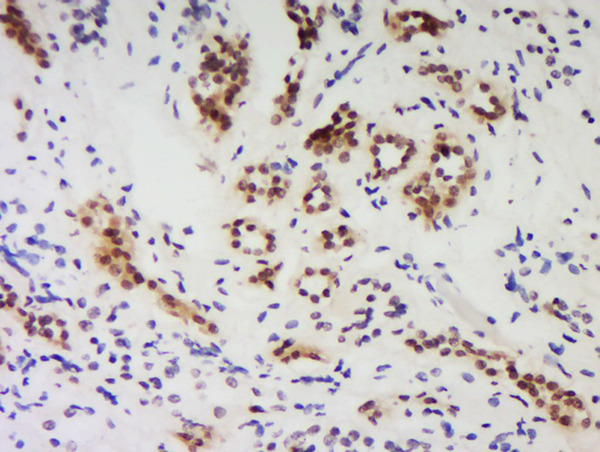 Formalin-fixed and paraffin embedded human kidney labeled with Anti-PNUTS/PPP1R10 Polyclonal Antibody Unconjugated (bs-11666R) at 1:200 followed by conjugation to the secondary antibody and DAB staining.