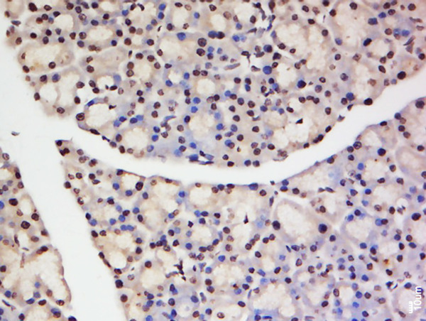 Paraformaldehyde-fixed, paraffin embedded rat pancreas; Antigen retrieval by boiling in sodium citrate buffer (pH6) for 15min; Block endogenous peroxidase by 3% hydrogen peroxide for 30 minutes; Blocking buffer (normal goat serum) at 37°C for 20min; Antibody incubation with Rabbit Anti-TNFAIP1 Polyclonal Antibody, Unconjugated (bs-2104R) at 1:200 overnight at 4°C, followed by a conjugated secondary and DAB staining.
