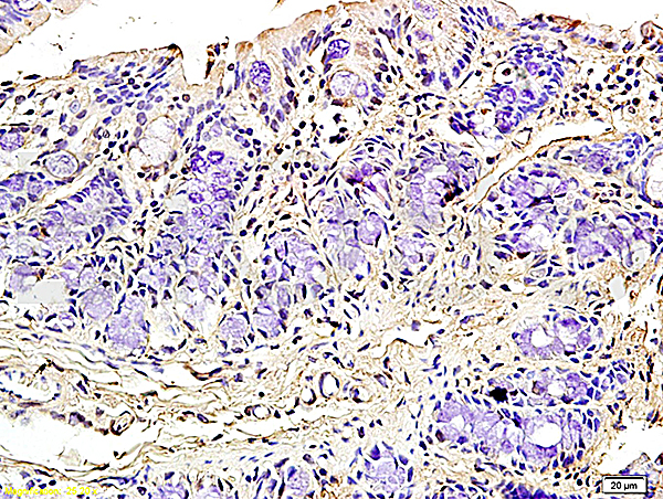 Formalin-fixed and paraffin embedded rat colitis tissue labeled with Rabbit Anti-Podoplanin/gp36 Polyclonal Antibody (bs-1048R), Unconjugated 1:200 followed by conjugation to the secondary antibody and DAB staining