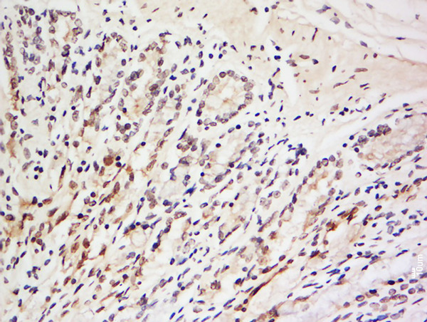 Formalin-fixed and paraffin embedded rat brain labeled with Anti-LRRC39 Polyclonal Antibody, Unconjugated (bs-12312R) at 1:200 followed by conjugation to the secondary antibody and DAB staining.\n