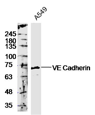 A549 lyates probed with Rabbit Anti-VE Cadherin Polyclonal Antibody, Unconjugated (bs-0878R) at 1:300 in 4˚C overnight. Followed by conjugation to secondary antibody (bs-0295G-HRP) at 1:5000 for 90min at 37˚C.