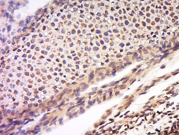 Paraformaldehyde-fixed, paraffin embedded mouse embryo; Antigen retrieval by boiling in sodium citrate buffer (pH6) for 15min; Block endogenous peroxidase by 3% hydrogen peroxide for 30 minutes; Blocking buffer (normal goat serum) at 37°C for 20min; Antibody incubation with Rabbit Anti-Noggin Polyclonal Antibody, Unconjugated (bs-2975R) at 1:200 overnight at 4°C, followed by a conjugated