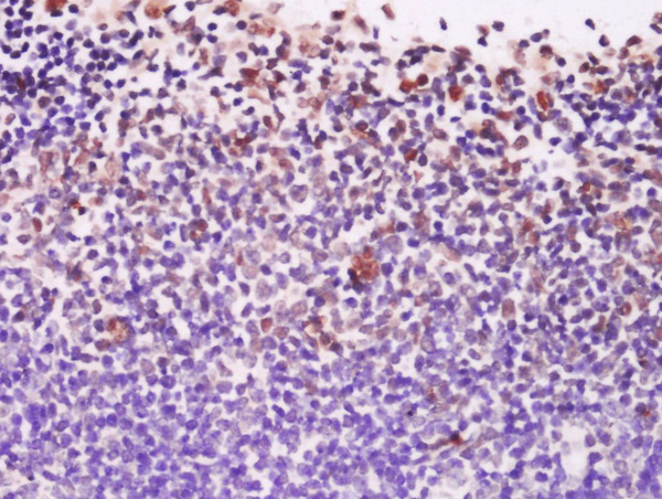 Formalin-fixed and paraffin embedded mouse lymph node labeled with Anti-EXOSC10/PMSCL2 Polyclonal Antibody, Unconjugated (bs-13120R) at 1:200 followed by conjugation to the secondary antibody and DAB staining.\n Formalin-fixed and paraffin embedded mouse lymph node labeled with Anti-EXOSC10/PMSCL2 Polyclonal Antibody, Unconjugated (bs-13120R) at 1:200 followed by conjugation to the secondary antibody and DAB staining.\n