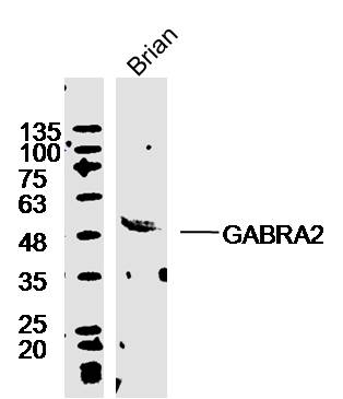 Mouse brain lysates probed with Rabbit Anti-GABRA2/GABA A Receptor alpha 2 Polyclonal Antibody, Unconjugated (bs-12061R ) at 1:300 overnight at 4˚C. Followed by a conjugated secondary antibody at 1:5000 for 90 min at 37˚C.