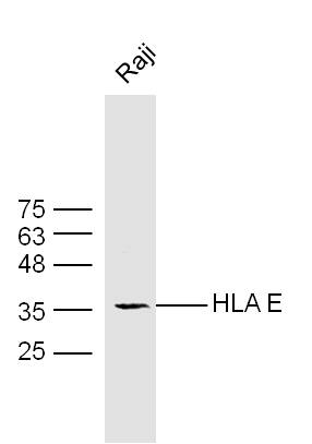 Raji cell lysates probed with Rabbit Anti-HLA E Polyclonal Antibody (bs-1279R) at 1:300 overnight at 4˚C. Followed by a conjugated secondary antibody (bs-0295G-HRP ) at 1:5000 for 90 min at 37˚C.