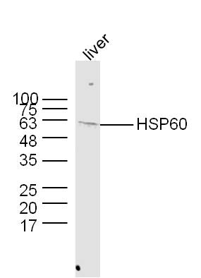 Mouse liver lysates probed with Rabbit Anti-HSP60 Polyclonal Antibody (bs-0191R) at 1:300 overnight at 4˚C. Followed by a conjugated secondary antibody (bs-0295G-HRP ) at 1:5000 for 90 min at 37˚C.